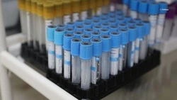 Проверяться на гепатит C нужно ежегодно — минздрав Ставрополья